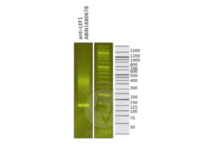 Cleavage Under Targets and Release Using Nuclease validation image for anti-Lymphoid Enhancer-Binding Factor 1 (LEF1) (AA 100-399) antibody (ABIN1680678)
