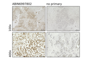Immunohistochemistry validation image for anti-Myosin IF (MYO1F) (AA 491-767) antibody (ABIN6997802)