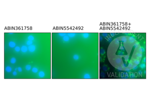 Proximity Ligation Assay validation image for anti-Phosphotyrosine antibody (ABIN361758)