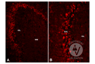 Immunohistochemistry validation image for anti-Reelin (RELN) (AA 3143-3461) antibody (ABIN7435136)