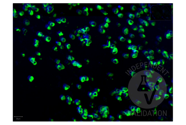 Recombinant SARS-CoV-2 Spike S1 抗体  (RBD)