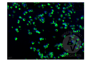 Multiplex Immunohistochemistry validation image for anti-SARS-CoV-2 Spike S1 (RBD) antibody (ABIN6952546)