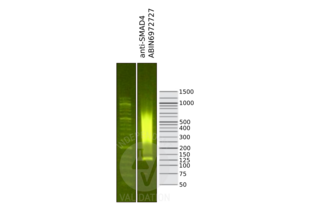 Library profiles comparing fragment size distributions on an E-Gel EX 2% agarose gel (Thermo Fisher). Fragments obtained from CUT&RUN using anti-SMAD4 ABIN6972727 (right) after library preparation, compared to the E-Gel Sizing DNA Ladder (Thermo Fisher) (left).