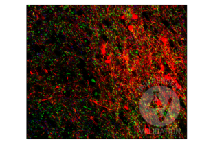 Multiplex Immunohistochemistry validation image for anti-Solute Carrier Family 32 (GABA Vesicular Transporter), Member 1 (SLC32A1) (N-Term) antibody (ABIN2855225)
