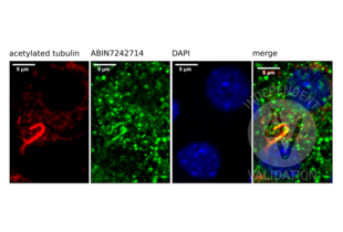 SSTR3 antibody