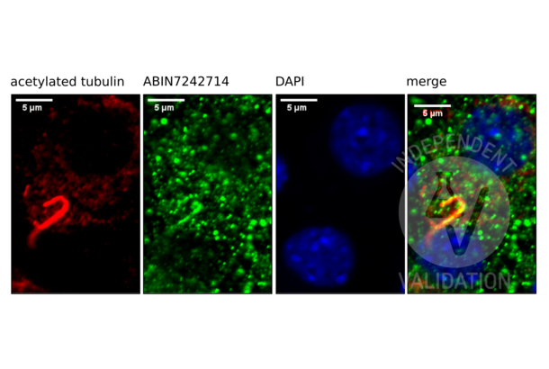 SSTR3 antibody