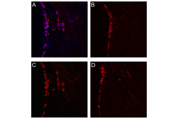 S1PR1 anticorps  (C-Term)