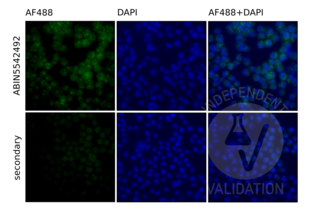 U937 monocytic cells stained with with ABIN5542492 (top row). TLR9 staining (AF488, green) shows typical peri-nuclear localization (ER). Counterstain with DAPI (blue). Negative control without primary antibody (bottom row) shows no significant staining. Counterstain with DAPI (blue). 