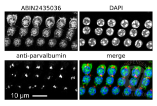 In this photograph of the 3 rows of cochlear outer hair cells taken with 63x objective, MYO7A is labeled with ABIN2435036 in green, nuclei are labeled with DAPI (blue), and red marks the parvalbumin signal. Note that MYO7A-positive cells are adjacent to the parvalbumin-positive synapses, as expected since MYO7A is expressed in the outer hair cells. MYO7A signal can thus be used to assist in the identification and counting of outer hair cells. 