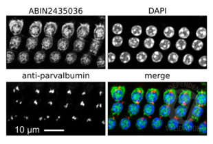 Myosin VIIA Antikörper