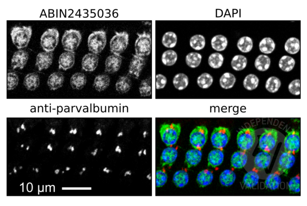 Myosin VIIA anticorps