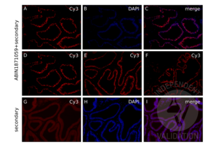 Immunofluorescence validation image for anti-Androgen Receptor (AR) antibody (ABIN1871059)