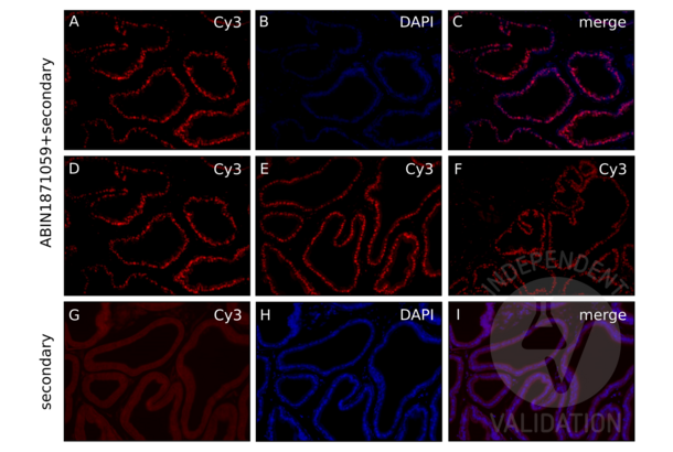 Androgen Receptor 抗体