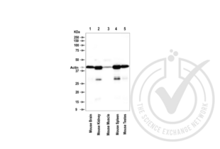 Figure 1. Western blot for beta actin (ACTB). Grey arrowhead indicates the expected molecular weight of ~42 kDa.