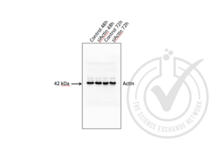 Figure 3. Western blot for beta actin (ACTB) using attempted siRNA silencing. Arrowhead indicates the expected molecular weight of ~42 kDa. HeLa cells were transfected with beta actin siRNA (Catalog number 12935141, Life Technologies) using Lipofectamine 2000, according to manufacturer's instructions. Total cell lysates were made from both floating and adherent cells harvested 48 hours and 72 hours after transfection. siRNA silencing of beta actin was not detected.