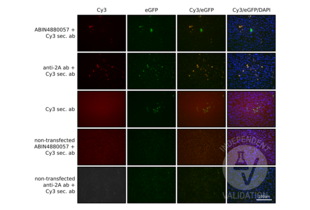 Immunofluorescence validation image for anti-CRISPR-Cas9 (N-Term) antibody (ABIN4880057)