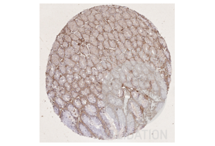 Immunohistochemistry validation image for anti-COL1A1/A2 antibody (ABIN5596819)