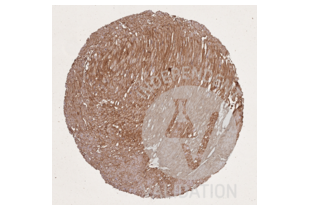 IHC staining of stomach muscular wall with collagen type I antibody ABIN5596819 diluted 1:15 shows collagen I fibres surrounding smooth muscle cells.