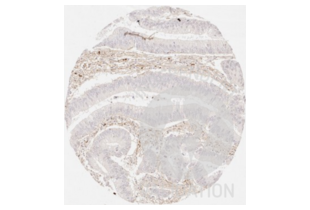 Immunohistochemistry validation image for anti-Collagen, Type III, alpha 1 (COL3A1) antibody (ABIN5596830)
