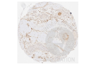 Immunohistochemistry validation image for anti-Collagen, Type III, alpha 1 (COL3A1) antibody (ABIN5596830)