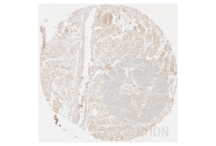 Immunohistochemistry validation image for anti-Collagen, Type III, alpha 1 (COL3A1) antibody (ABIN5596830)