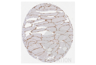 Immunohistochemistry validation image for anti-Collagen, Type IV (COL4) antibody (ABIN5596835) (Collagen IV 抗体)