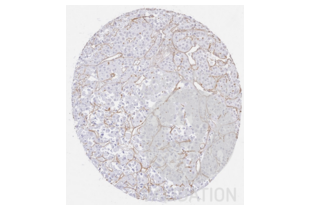 Immunohistochemistry validation image for anti-Collagen, Type IV (COL4) antibody (ABIN5596835) (Collagen IV 抗体)