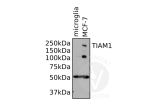 TIAM1 anticorps  (AA 1-378)