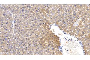 Detection of LCAT in Mouse Liver Tissue using Polyclonal Antibody to Lecithin Cholesterol Acyltransferase (LCAT) (LCAT 抗体  (AA 41-210))