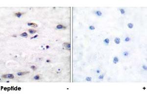 Immunohistochemical analysis of paraffin-embedded human brain tissue using GRIA1 polyclonal antibody . (Glutamate Receptor 1 抗体)