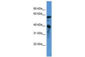Image no. 1 for anti-Calponin 3, Acidic (CNN3) (C-Term) antibody (ABIN6746734) (CNN3 抗体  (C-Term))