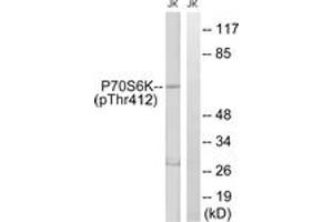 Western blot analysis of extracts from Jurkat cells treated with Insulin 0. (RPS6KB1 抗体  (pThr412))