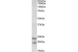 ABIN1590127 (0. (IL-25 抗体  (AA 66-79))