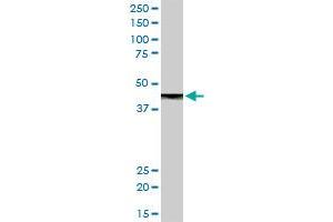 CPB1 MaxPab rabbit polyclonal antibody. (CPB1 抗体  (AA 1-417))