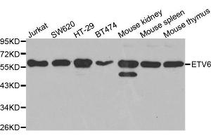 Western blot analysis of extracts of various cell lines, using ETV6 antibody. (ETV6 抗体  (AA 1-300))