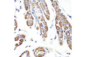 Immunohistochemistry of paraffin-embedded human stomach using RNF149 antibody (ABIN7270062) at dilution of 1:100 (40x lens). (RNF149 抗体  (AA 221-400))