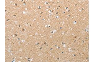 The image on the left is immunohistochemistry of paraffin-embedded Human brain tissue using ABIN7192728(TACR2 Antibody) at dilution 1/20, on the right is treated with synthetic peptide. (TACR2 抗体)