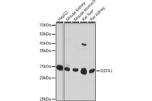 Western blot analysis of extracts of various cell lines, using GST antibody (8266) at 1:1000 dilution.