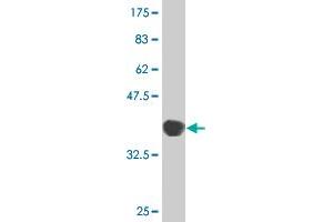 Western Blot detection against Immunogen (37. (Thyroperoxidase 抗体  (AA 672-779))