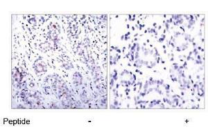Image no. 1 for anti-Signal Transducer and Activator of Transcription 3 (Acute-Phase Response Factor) (STAT3) (AA 725-729) antibody (ABIN197176) (STAT3 抗体  (AA 725-729))