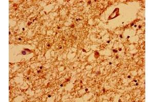 Immunohistochemistry of paraffin-embedded human brain tissue using ABIN7172228 at dilution of 1:100 (TRNP1 抗体  (AA 10-180))