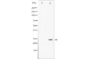 Western blot analysis of BAD phosphorylation expression in Forskolin treated NIH-3T3 whole cell lysates,The lane on the left is treated with the antigen-specific peptide. (BAD 抗体  (pSer136))