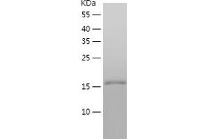 Western Blotting (WB) image for Tumor Necrosis Factor (Ligand) Superfamily, Member 9 (TNFSF9) (AA 71-254) protein (His tag) (ABIN7125533)