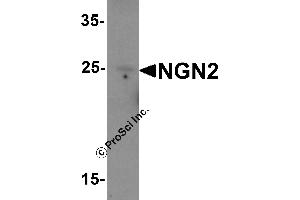 Western Blotting (WB) image for anti-Neurogenin 2 (NEUROG2) (C-Term) antibody (ABIN1077397) (Neurogenin 2 抗体  (C-Term))