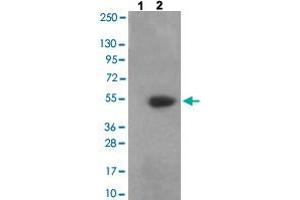Western blot analysis of Lane 1: antigen-specific peptide treated 3T3 cells, Lane 2: 3T3 cells with CAMK2A/CAMK2B/CAMK2D (phospho T305) polyclonal antibody  at 1:500-1:1000 dilution. (CAMK2A 抗体  (pThr305))