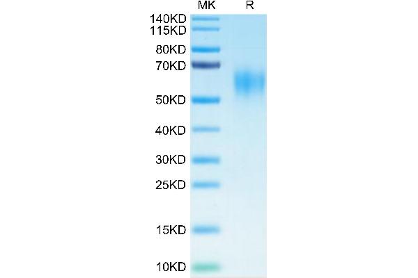 IL15RA Protein (His-Avi Tag)