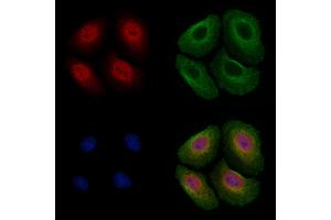 ABIN6255339 and ABIN6267494 staining Hela cells(4h of LPS treatment) by IF/ICC. (SREBF1 抗体  (pSer439))