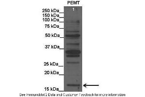 Lanes:   Lane1: 20 ug rat liver lysate  Primary Antibody Dilution:   1:1000  Secondary Antibody:   Anti-rabbit HRP  Secondary Antibody Dilution:   1:15000  Gene Name:   PEMT  Submitted by:   Anonymous (PEMT 抗体  (C-Term))
