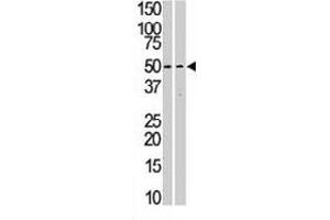 The STK38L polyclonal antibody  is used in Western blot to detect STK38L in Jurkat (left) and T-47D (right) cell line lysates. (STK38L 抗体  (C-Term))