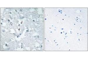 Immunohistochemistry analysis of paraffin-embedded human brain tissue, using GLCTK Antibody. (GLYCTK 抗体  (AA 101-150))